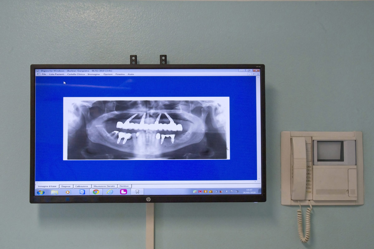 impianti zigomatici a cremona