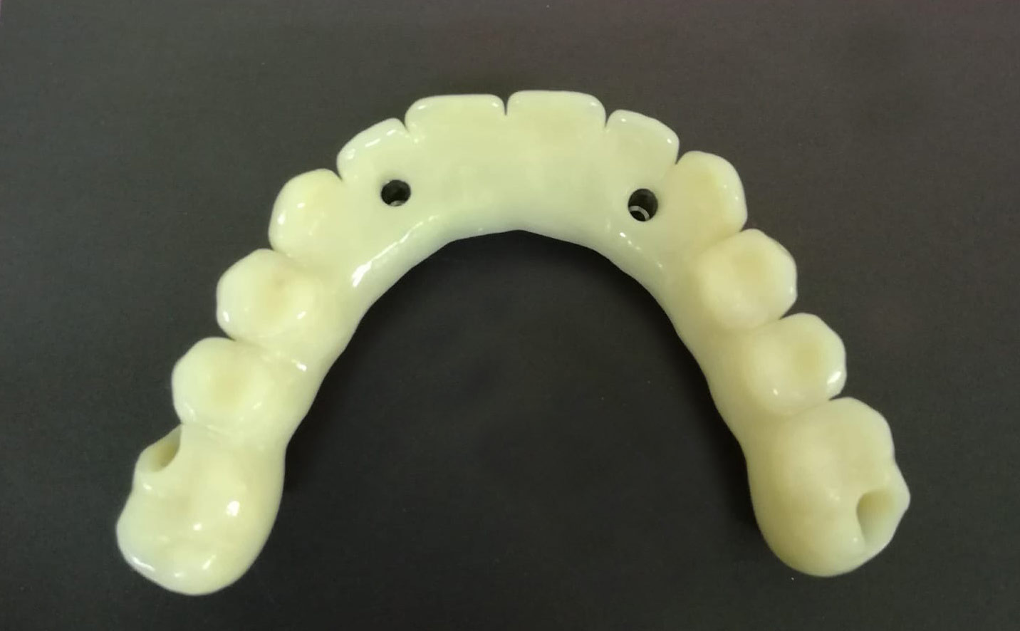 implantologia a carico immediato cremona