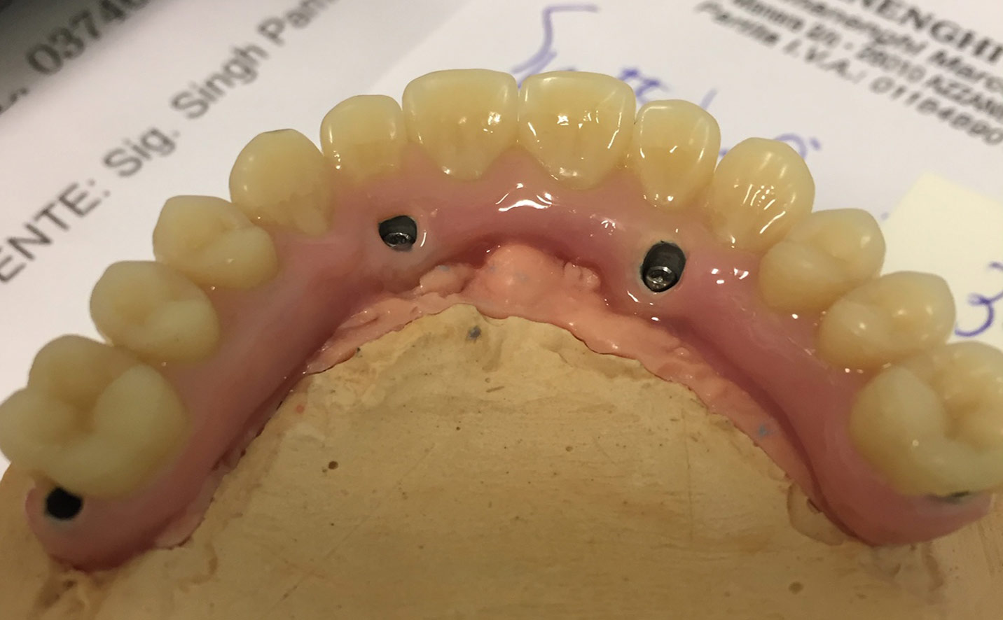 implantologia a carico immediato cremona